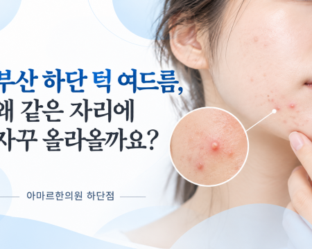턱 여드름이 반복되는 원인과 좁쌀·면포, 염증성 여드름, 민감성 피부의 치료 방향을 설명한 아마르한의원 하단점 피부가이드
