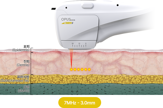 카트리지 3.0mm